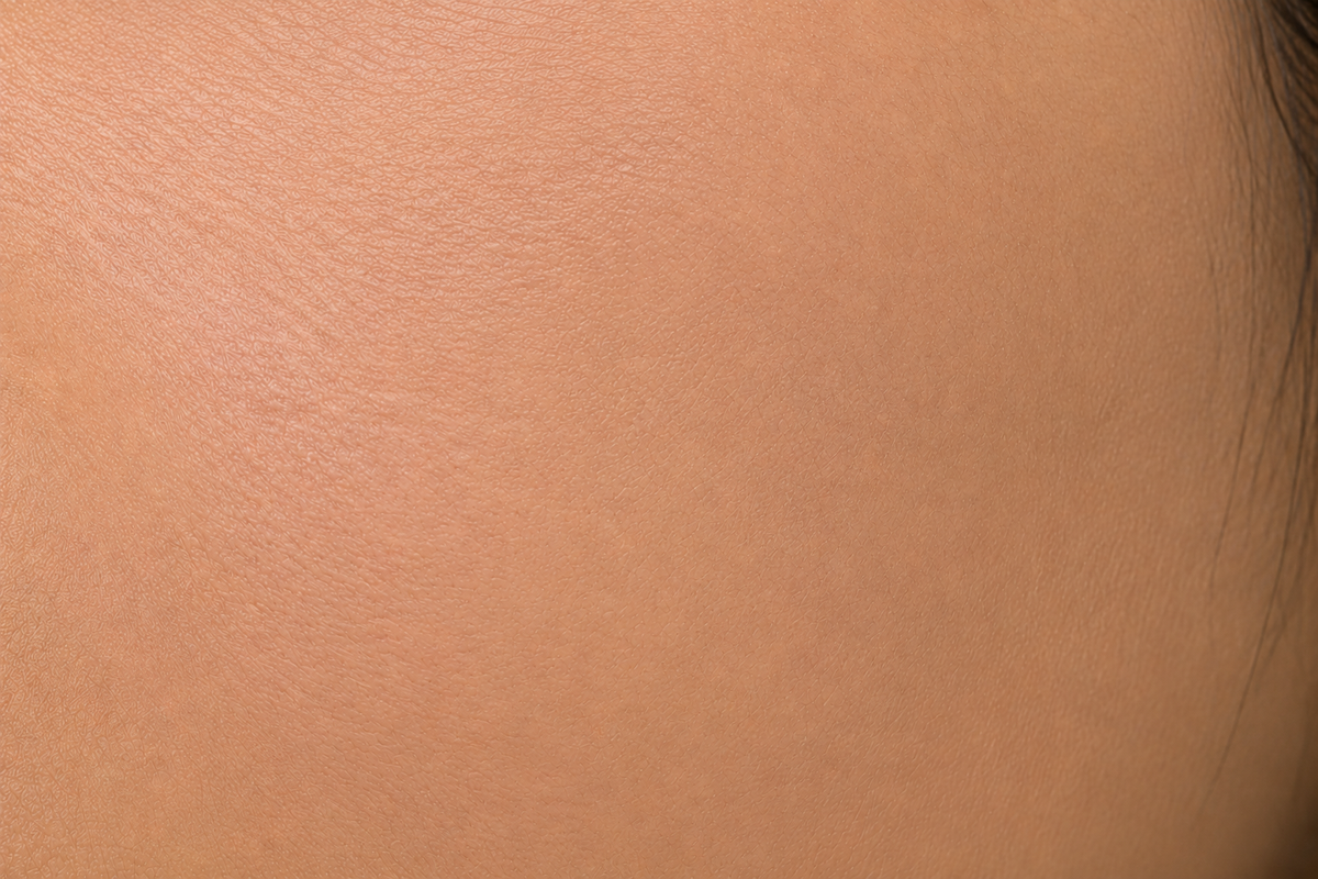 After using Cosmelan Cream